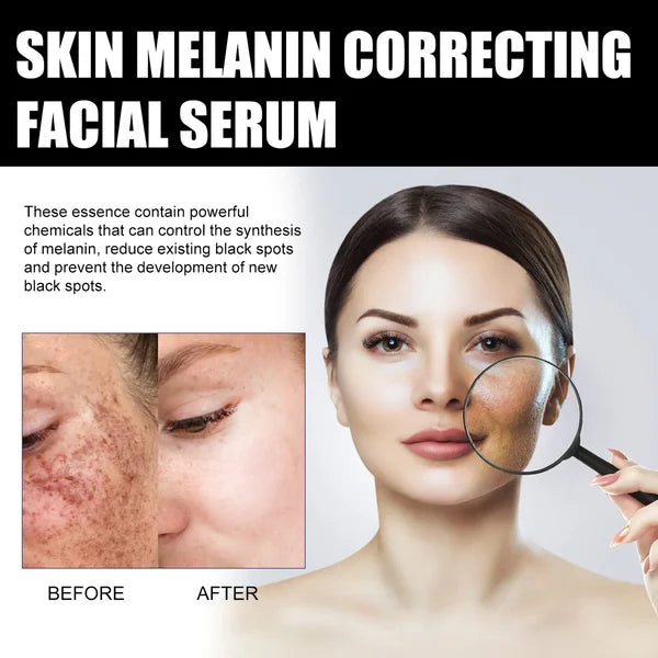 🔥Last Day Promotion 30% OFF-Melanin Correcting Facial Serum