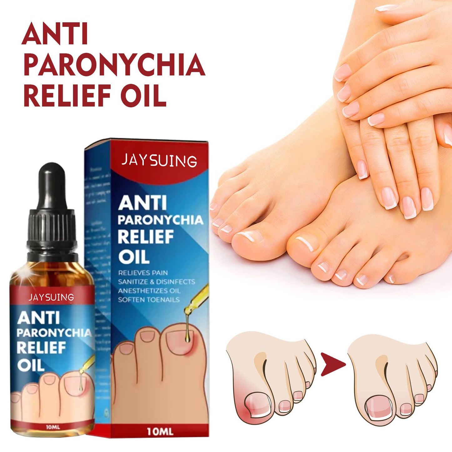 Hot Summer Sale 30%OFF!Paronychia Relief Oil