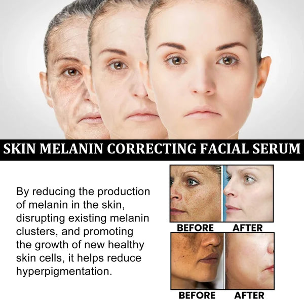 🔥Last Day Promotion 30% OFF-Melanin Correcting Facial Serum