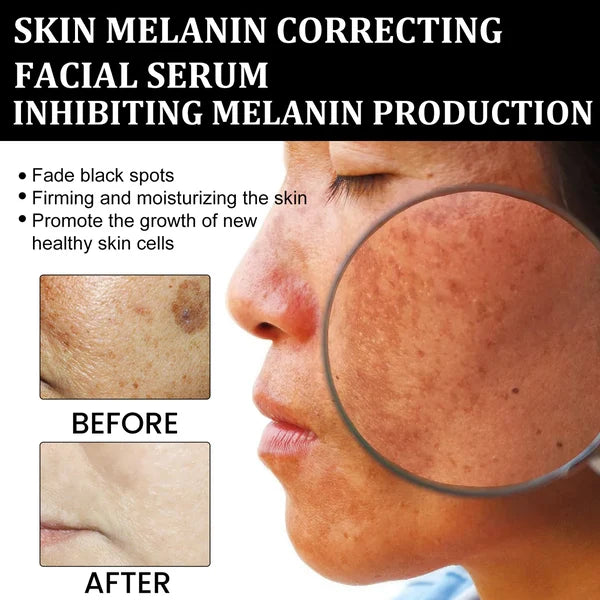 🔥Last Day Promotion 30% OFF-Melanin Correcting Facial Serum